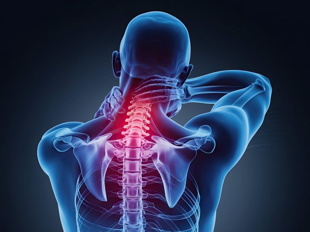 Nackenschmerzen aufgedeckt: 3D-Anatomie zeigt Nackenentzündung