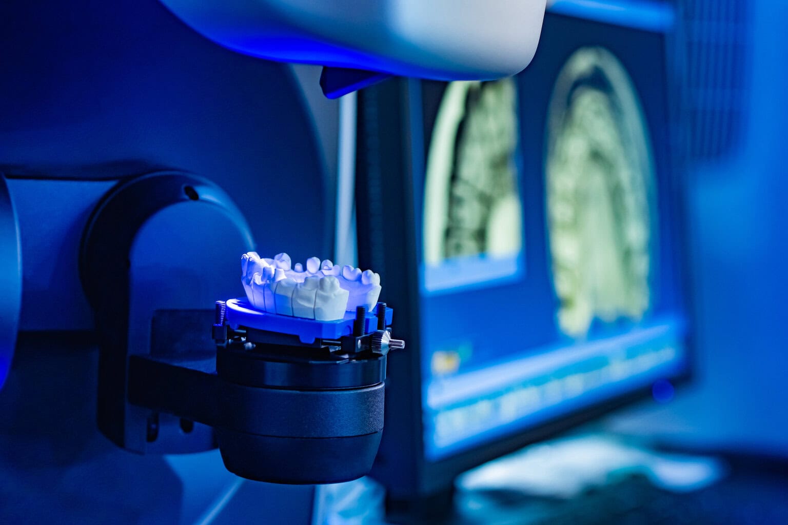 Gebissmodell Mockup und digital in tiefblau Labor