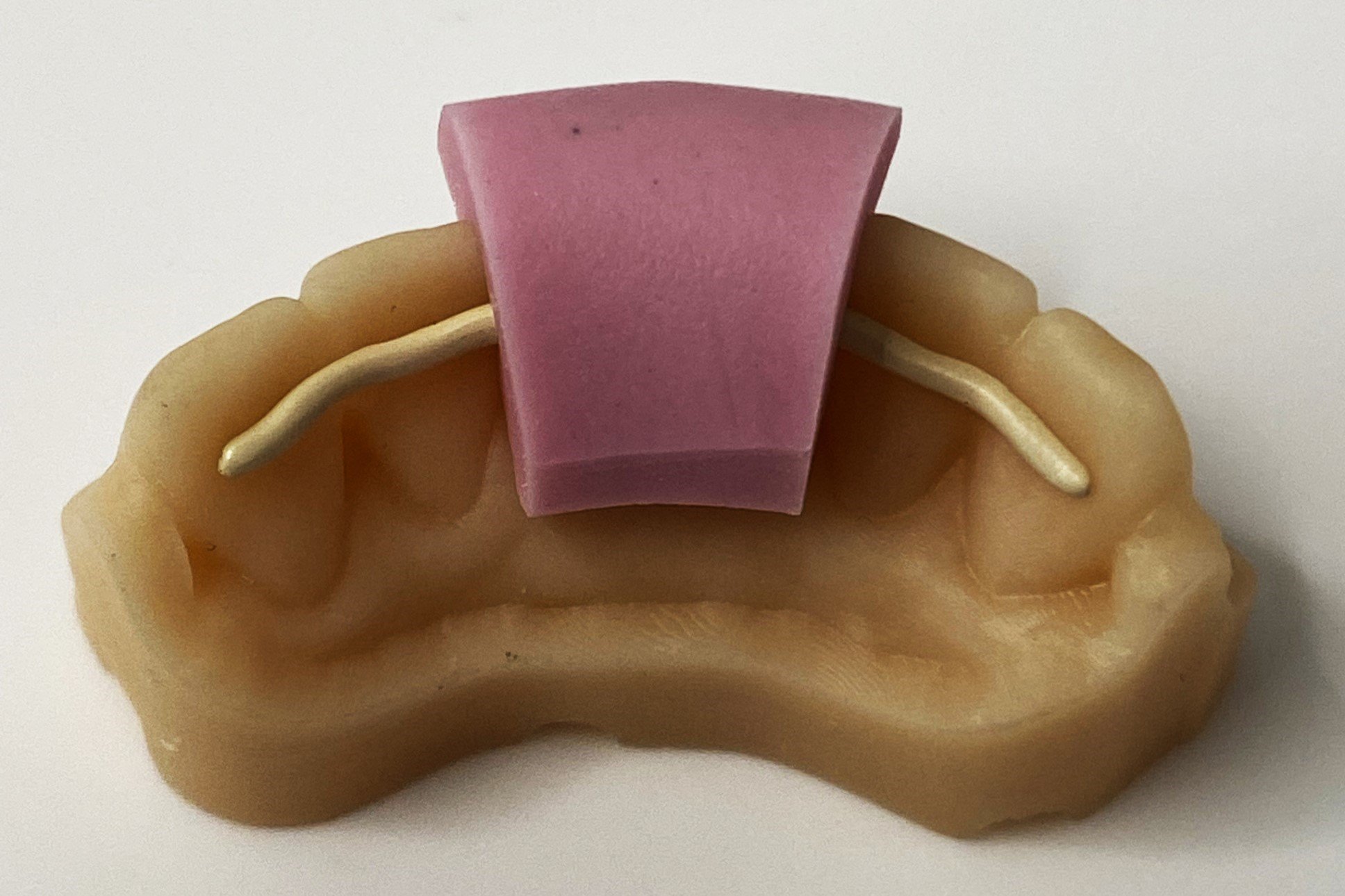 retainer nahaufnahme, braun-rosa